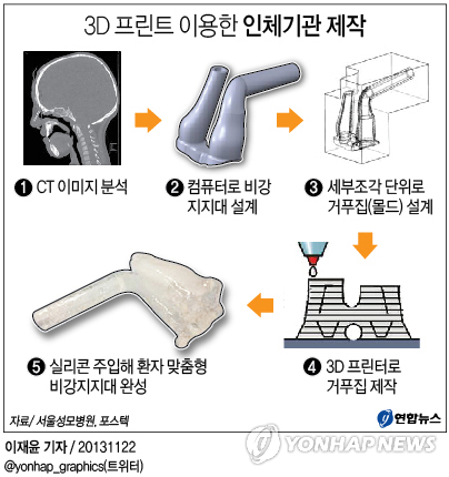 <그래픽/> 3D 프린트 이용한 인체기관 제작