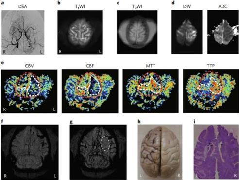 韩中研究组成功进行新型MRI造影剂灵长类试验