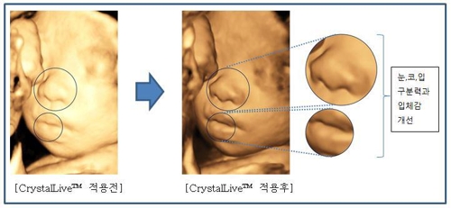 Samsung to introduce latest ultrasound image processing engine