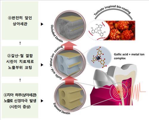 멍게 유래 시린이 치료소재 원리<<해양수산부 제공>>