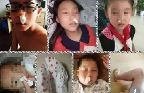 독성 물질이 포함된 학교 트랙으로 인해 코피를 흘리는 중국 어린이들홍콩 사우스차이나모닝포스트(SCMP) 캡처